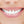 Healthy Gum Professional Teeth Whitening System